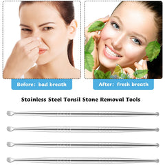 Stainless steel tonsil stone remover tools laid out