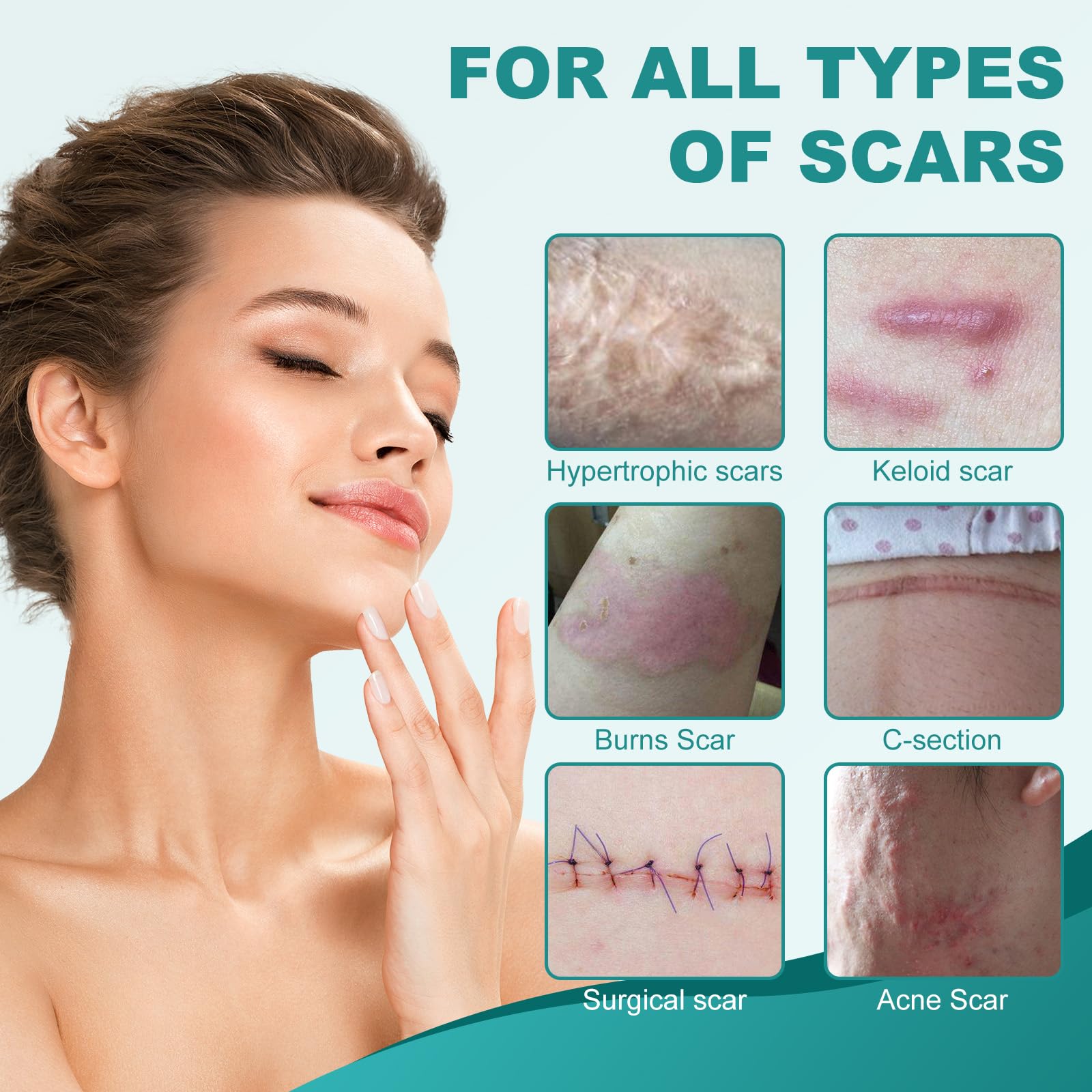 Nullam silicone scar sheets worn on skin—nearly invisible under daily clothing.