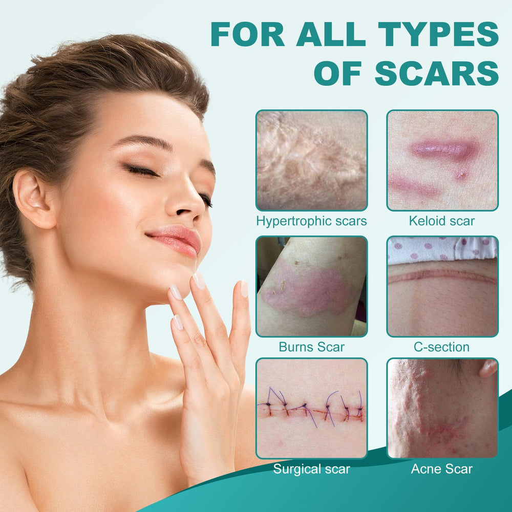 Nullam silicone scar sheets worn on skin—nearly invisible under daily clothing.