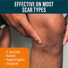 NUVADERMIS Advanced Scar Gel textured gel ready for gentle massage and absorption.