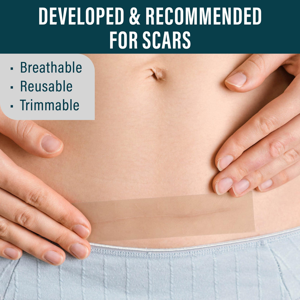 NUVADERMIS scar tape cut to fit a curved scar shape