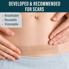NUVADERMIS scar tape cut to fit a curved scar shape