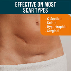 NUVADERMIS medical-grade-silicone-sheet closeup texture indicates quality and safety.
