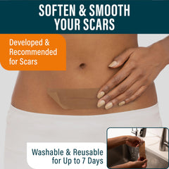 NUVADERMIS scar-tape-roll for large-area scar coverage.