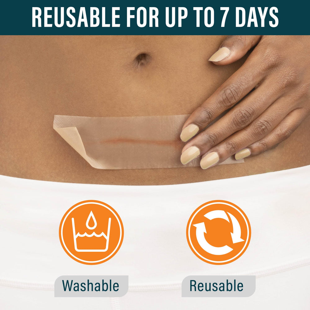 NUVADERMIS tummy tuck scar care tape wrapped around the abdomen