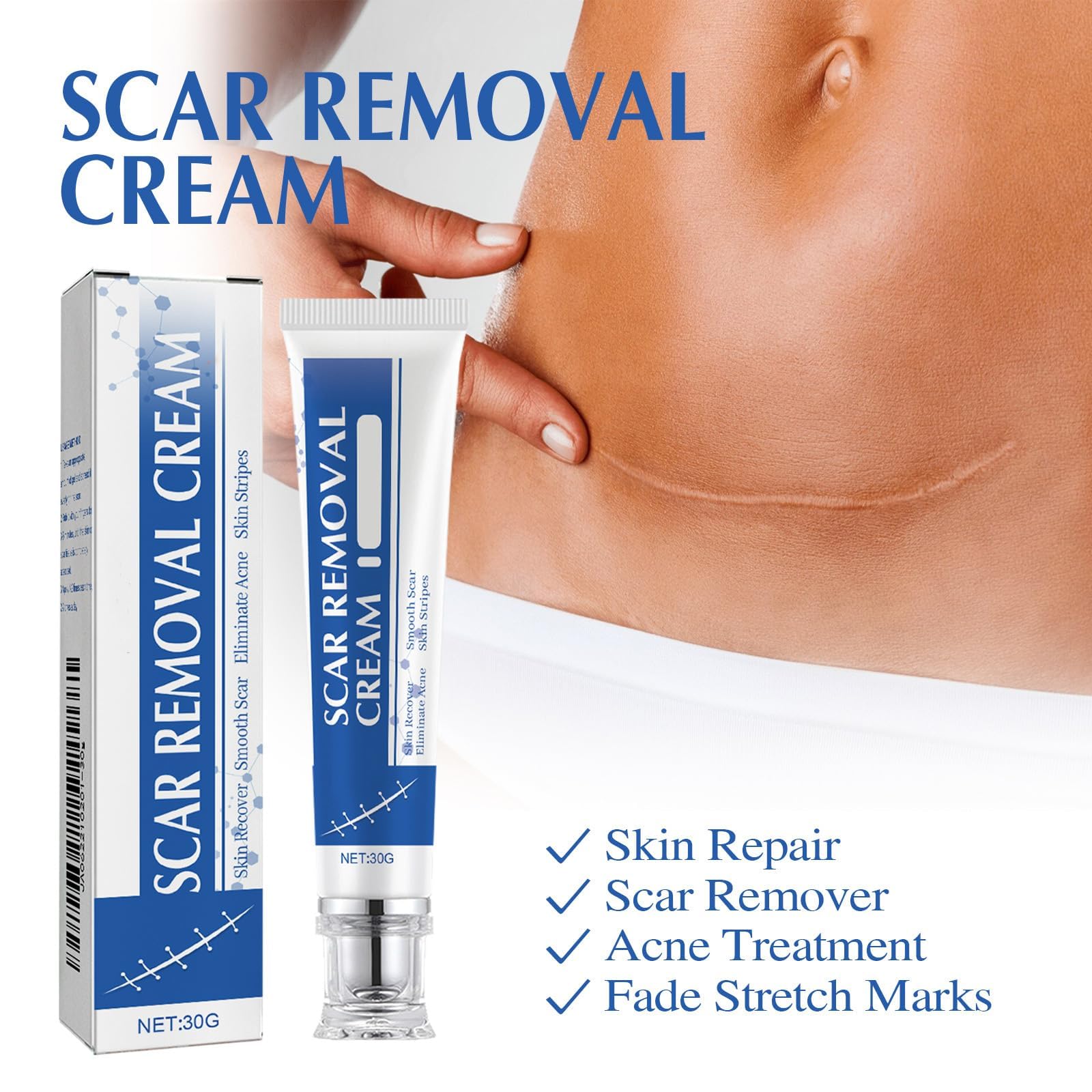 NYYQYYN Scar Removal Cream helps improve scar appearance over time.