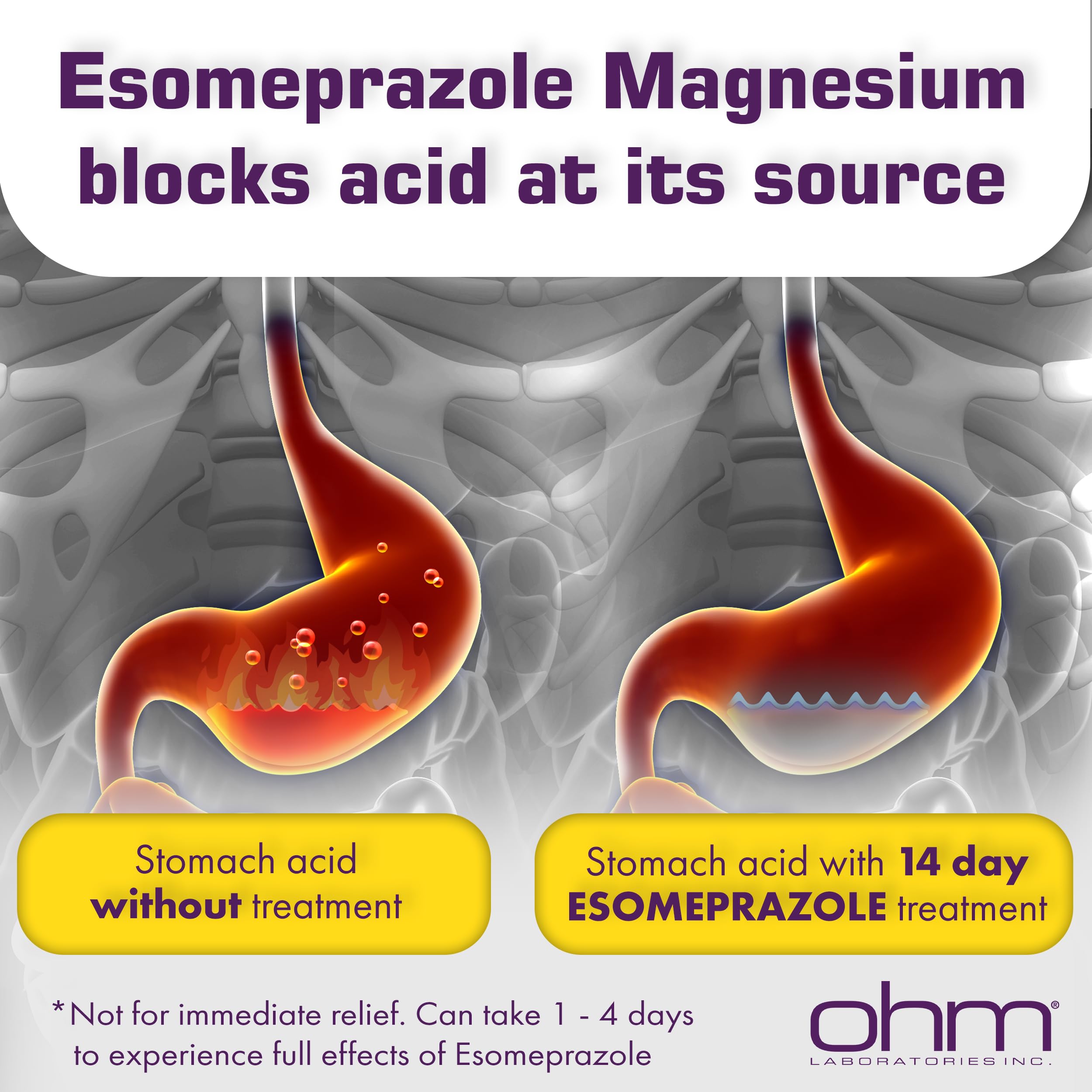 Ohm 24-hour relief timeline graphic illustrating gradual acid reduction.