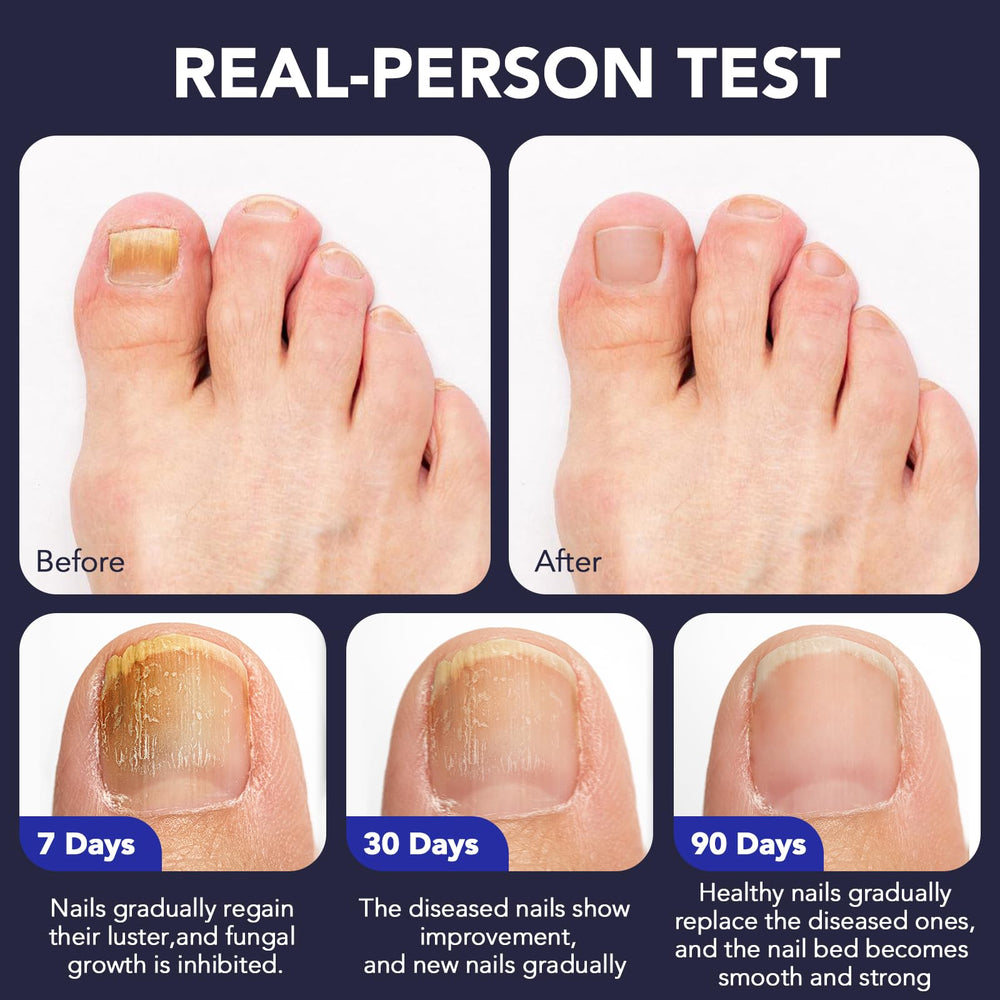 OMZOK athletes-use-friendly design for on-the-go nail care.