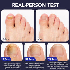 OMZOK athletes-use-friendly design for on-the-go nail care.