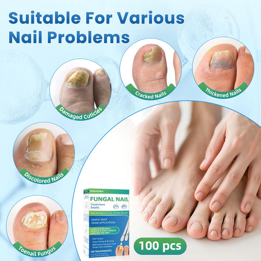 ONIADBA fungal-nail-swabs-application shows precise nail-bed delivery.