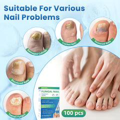 ONIADBA fungal-nail-swabs-application shows precise nail-bed delivery.