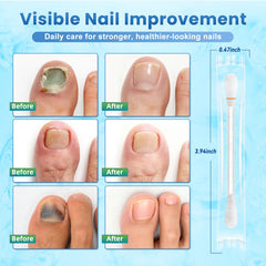 ONIADBA fungal-nail-swabs-packaging indicates 100 treatments for family care.