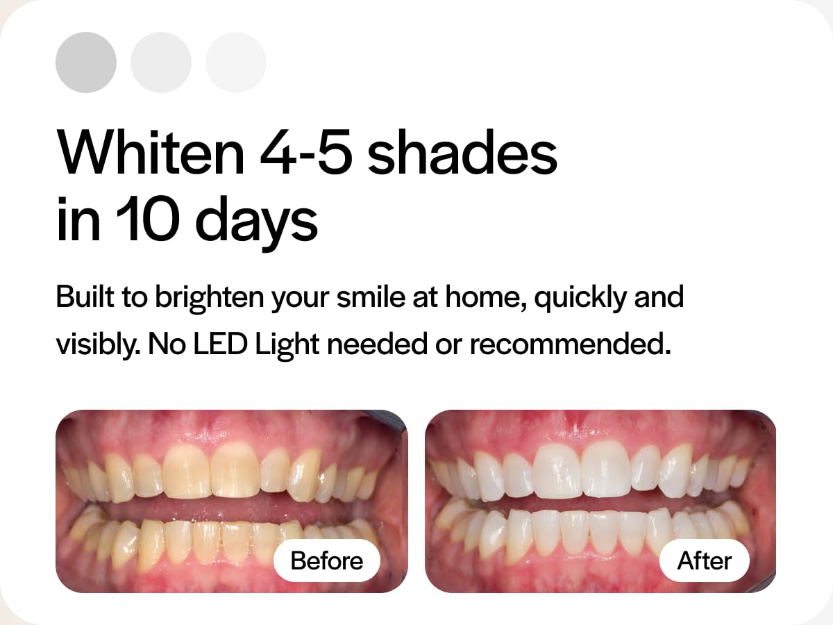 Tray compatibility with Invisalign and aligners