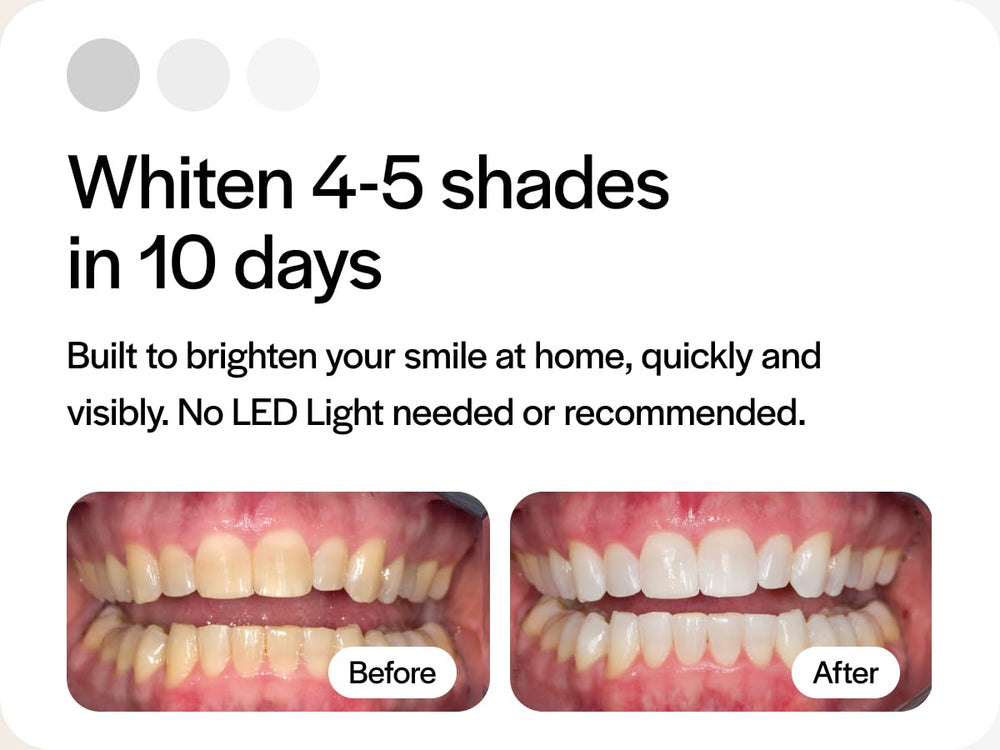 Tray compatibility with Invisalign and aligners
