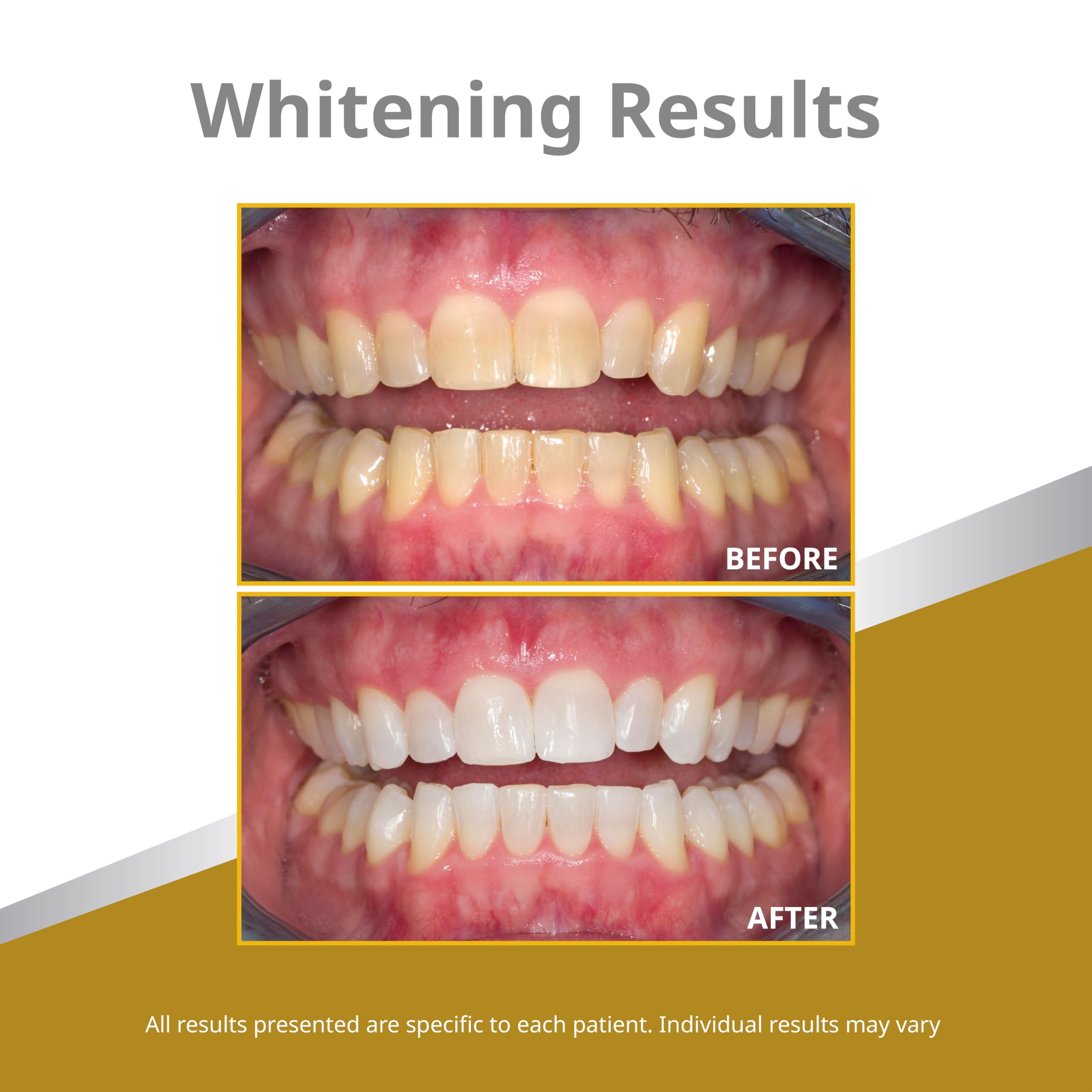 Whitening gel refill pack for Opalescence PF 45% – 4 x 1.2 ml mint