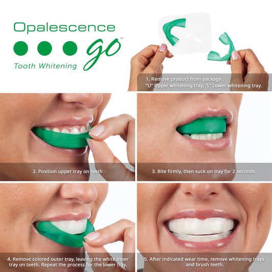 Opalescence Go 10% prefixed whitening trays close-up with gel inside