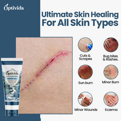 OPTIVIDA Colloidal Silver Gel on rash relief helps calm irritated skin.