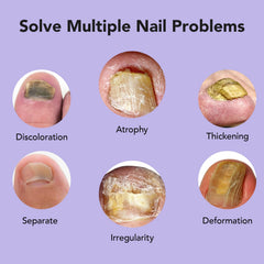 ourui one ingrown toenail treatment feature highlights targeted relief in problem areas