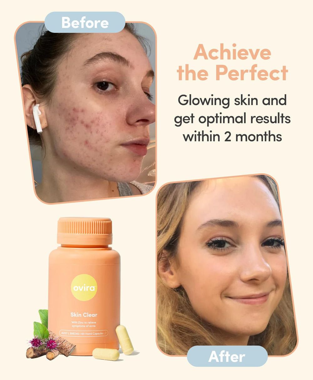 Two Ovira Skin Clear capsules for daily dosage