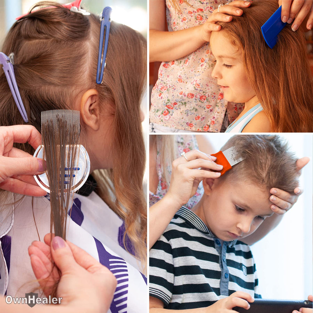 OWNHEALER dandruff comb close-up designed for scalp care and flake reduction.