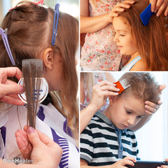 OWNHEALER dandruff comb close-up designed for scalp care and flake reduction.