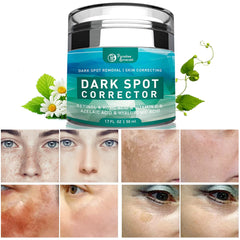 Paradise Emerald Dark Spot Remover packaging highlights a premium solution for a more even complexion.