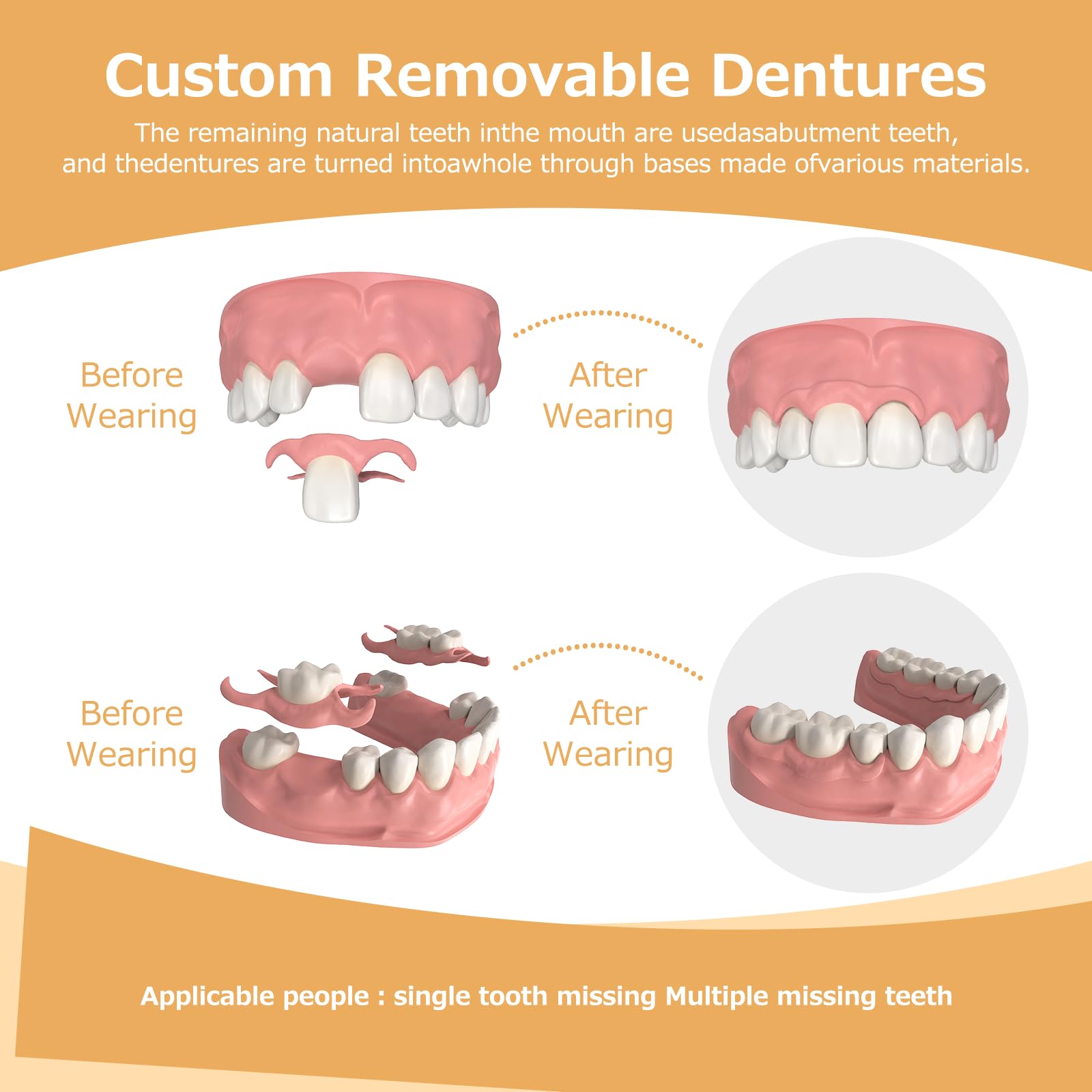 Affordable custom dentures from Initsmil Lab