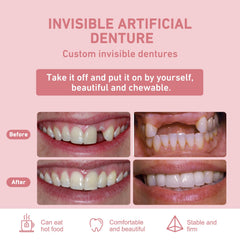 Removable partial dentures for easy daily cleaning and maintenance