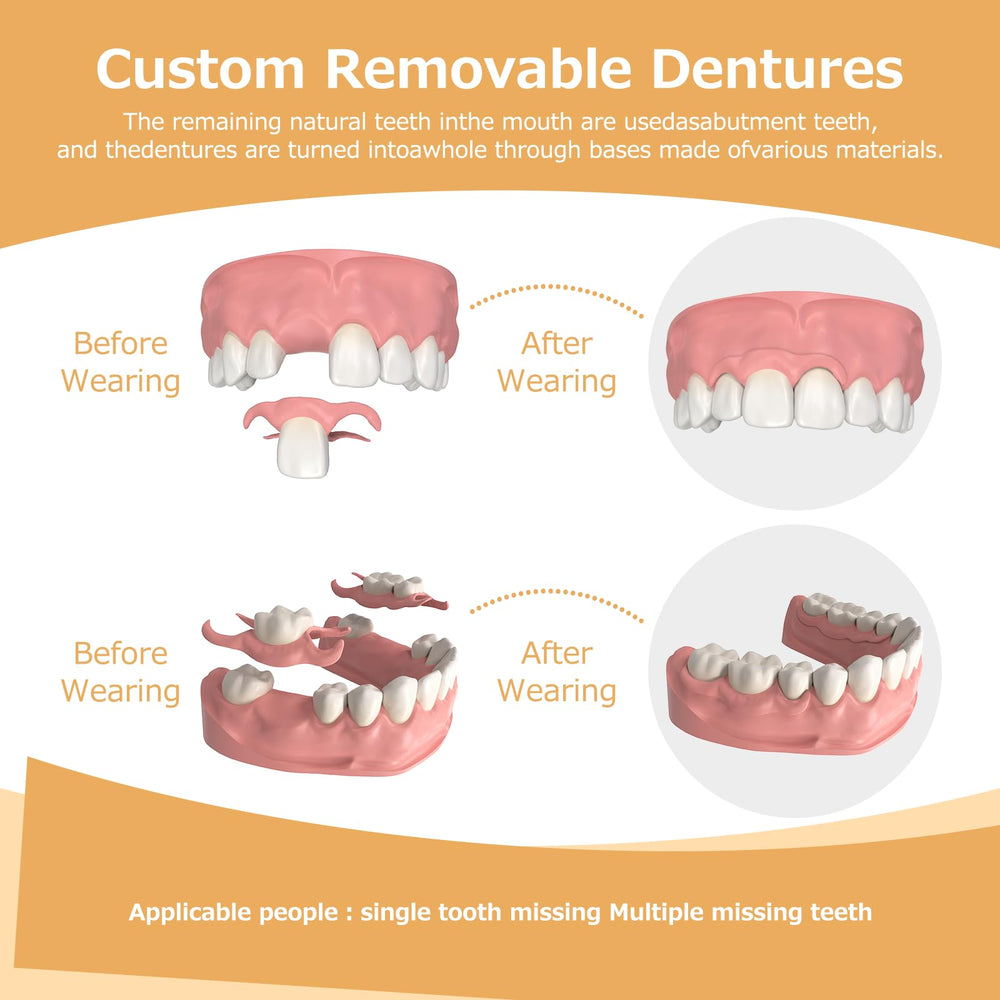 Custom denture created by Initsmil Lab at affordable price