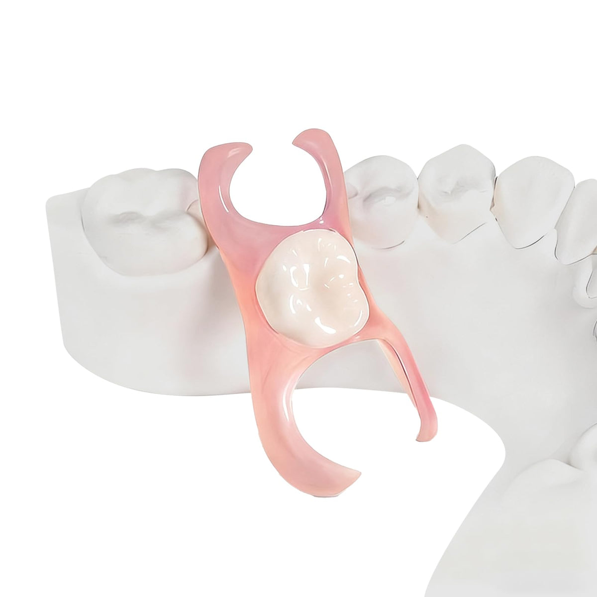 Custom partial dentures designed to fit a single missing tooth with natural color match