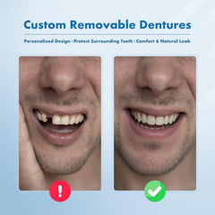 Removable design of personalized partial dentures for easy cleaning
