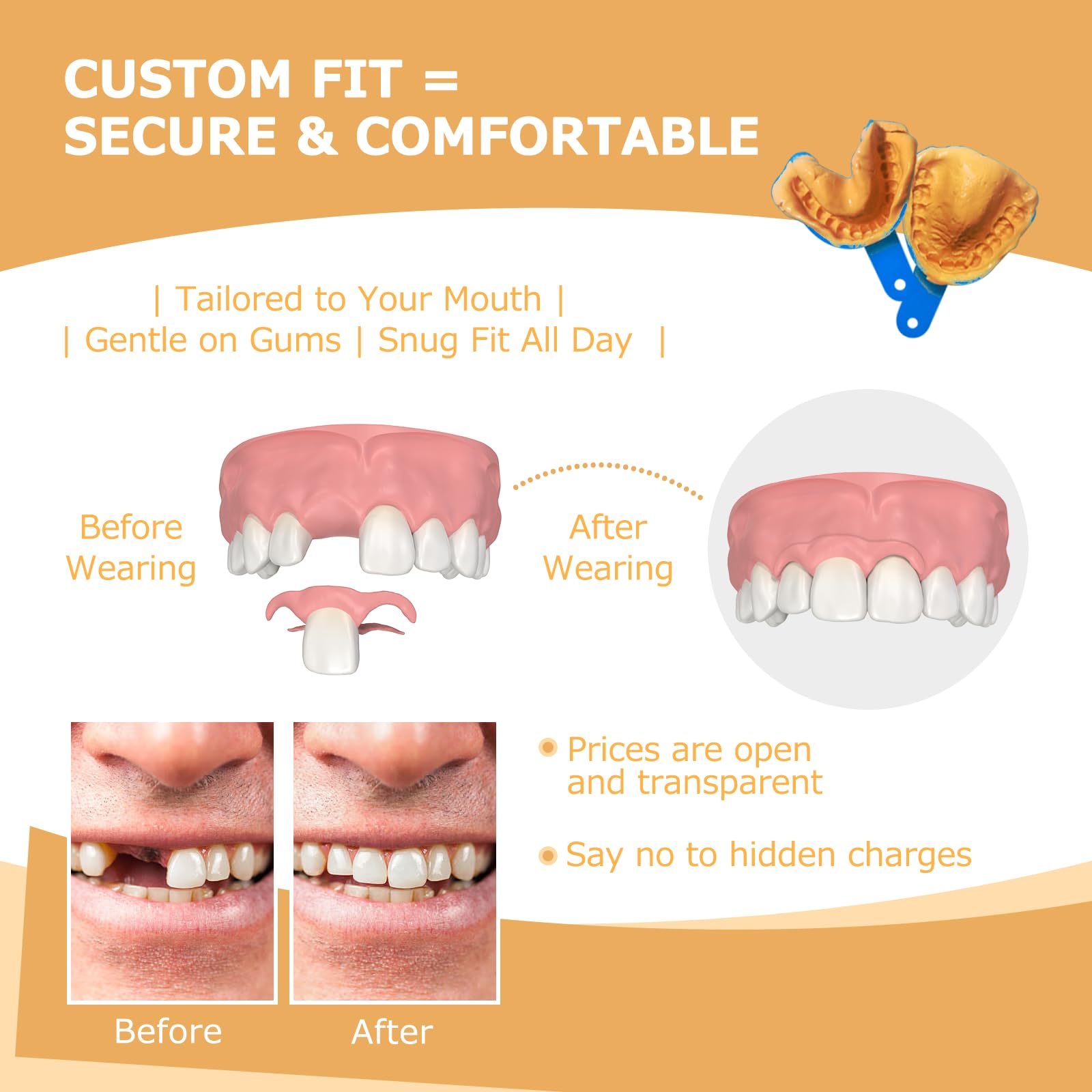 Flexible tooth options from 1 to 6 replacement teeth