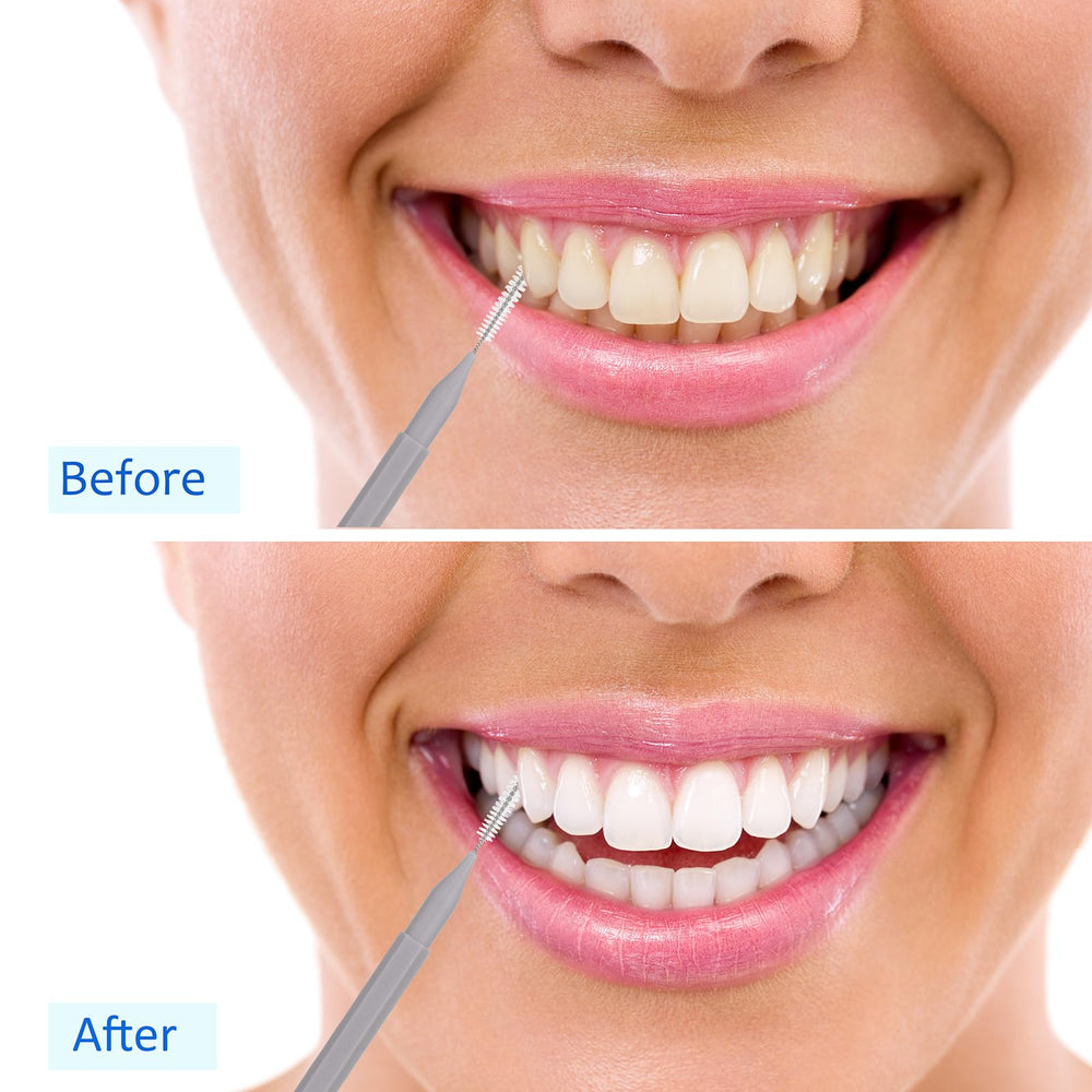 Package includes 100 interdental brushes in multiple colors