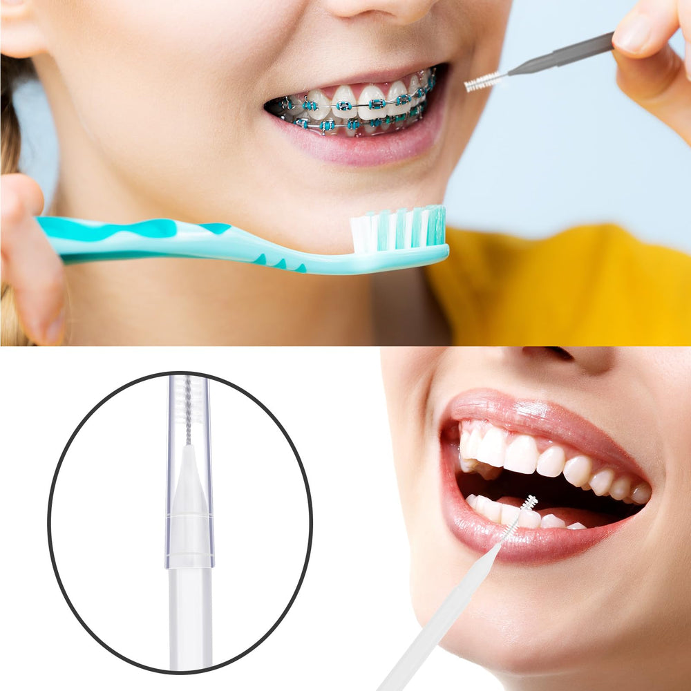 Soft nylon-coated braces brush safe for gums