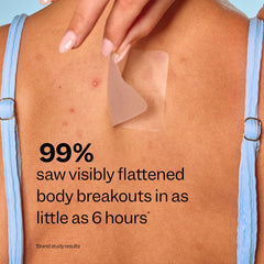 Peach Slices derm-approved design ensures gentle wear and reliable protection overnight.