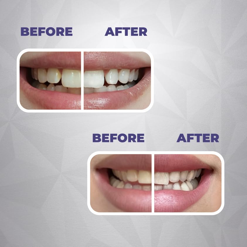 Peroxide-free whitening formula illustration
