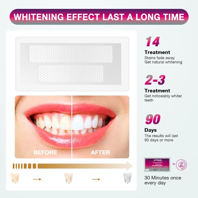 Stain removal from coffee, tea, and wine with whitening strips