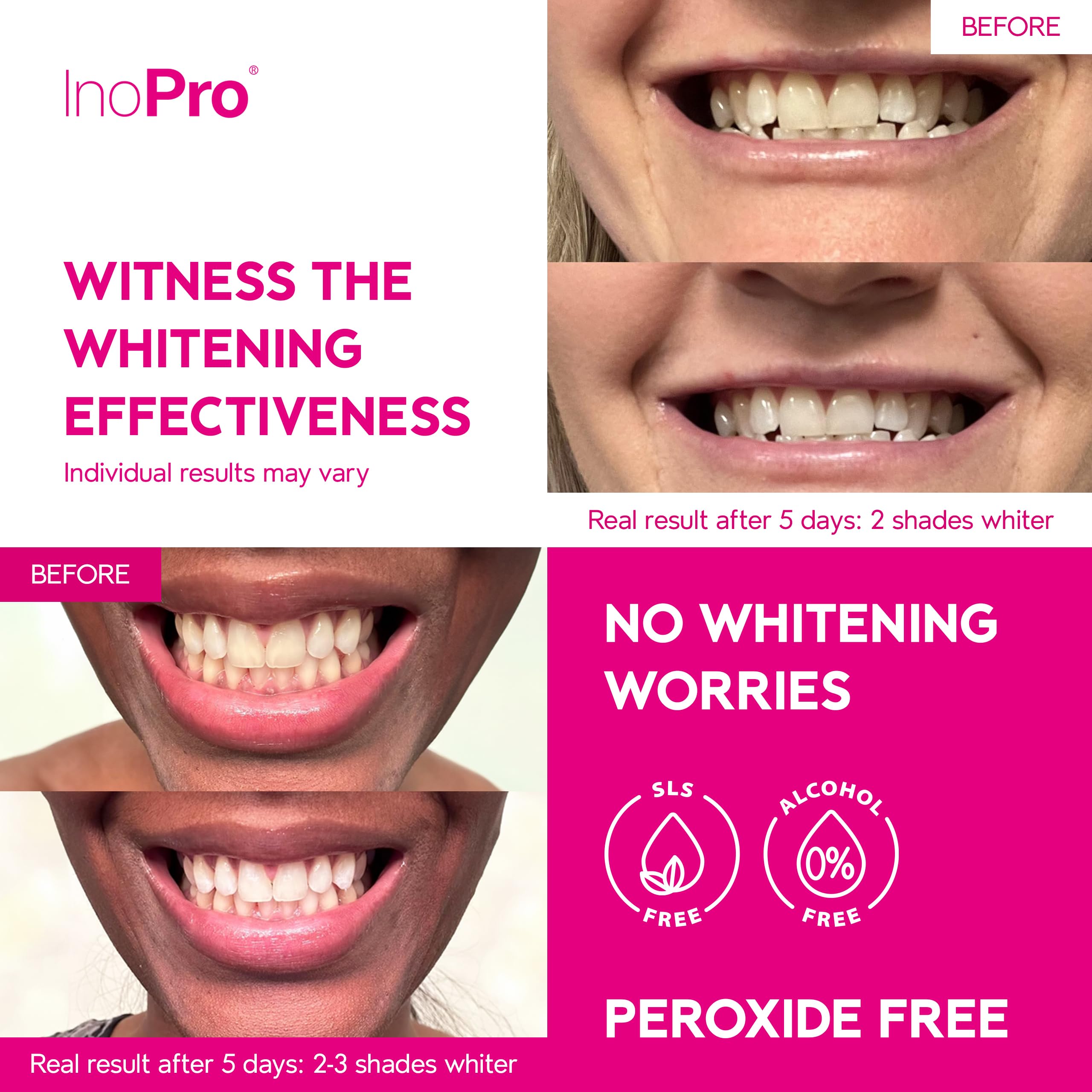 Peroxide-free whitening formula for gentle teeth whitening