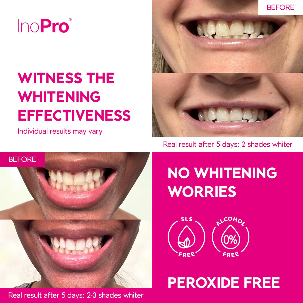 Peroxide-free whitening formula for gentle teeth whitening