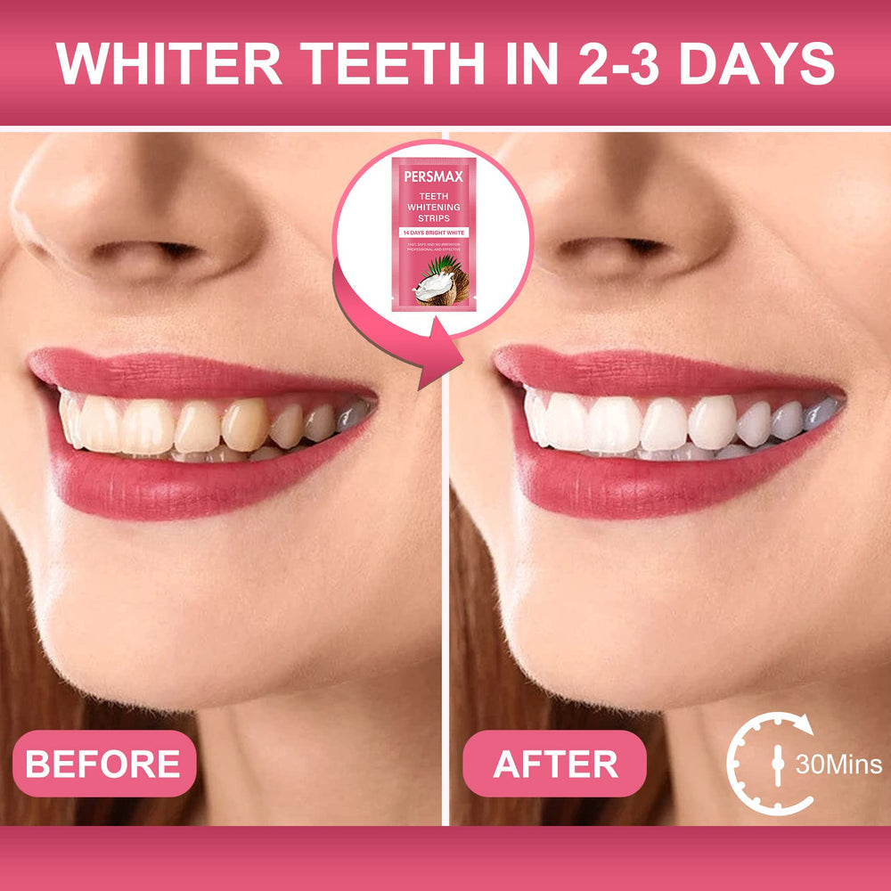 Complete 14-day whitening system with progress shade guide