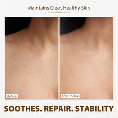Massage oil application on skin for absorption