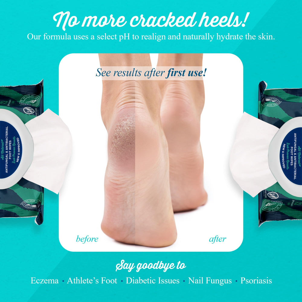 pHeet Foot Wipes on the go pack for portable foot care