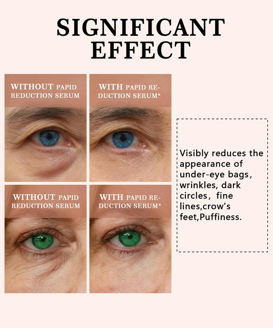 Phydrulis instant eye serum dispenses precisely to depuff and brighten the eye area.