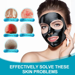 POP MODERN.C Blackhead removal tools set shown for at-home pore cleansing