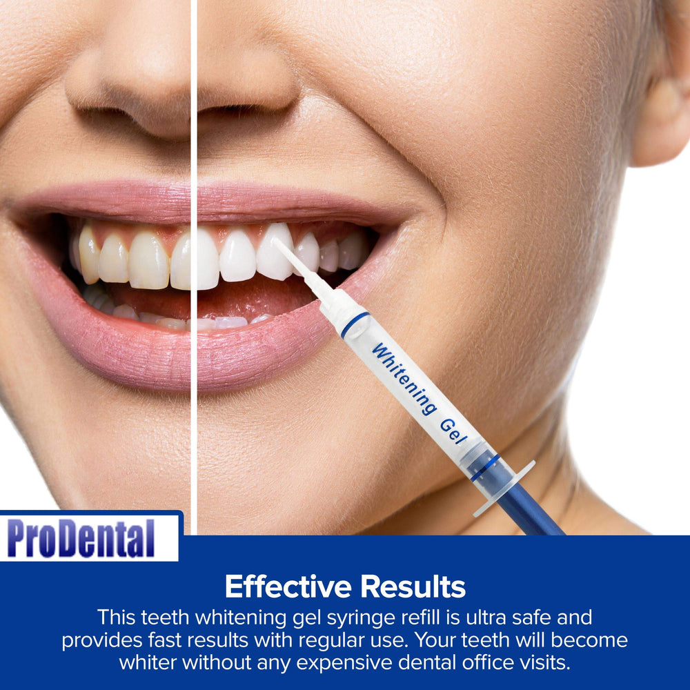Close-up of whitening gel being applied to teeth