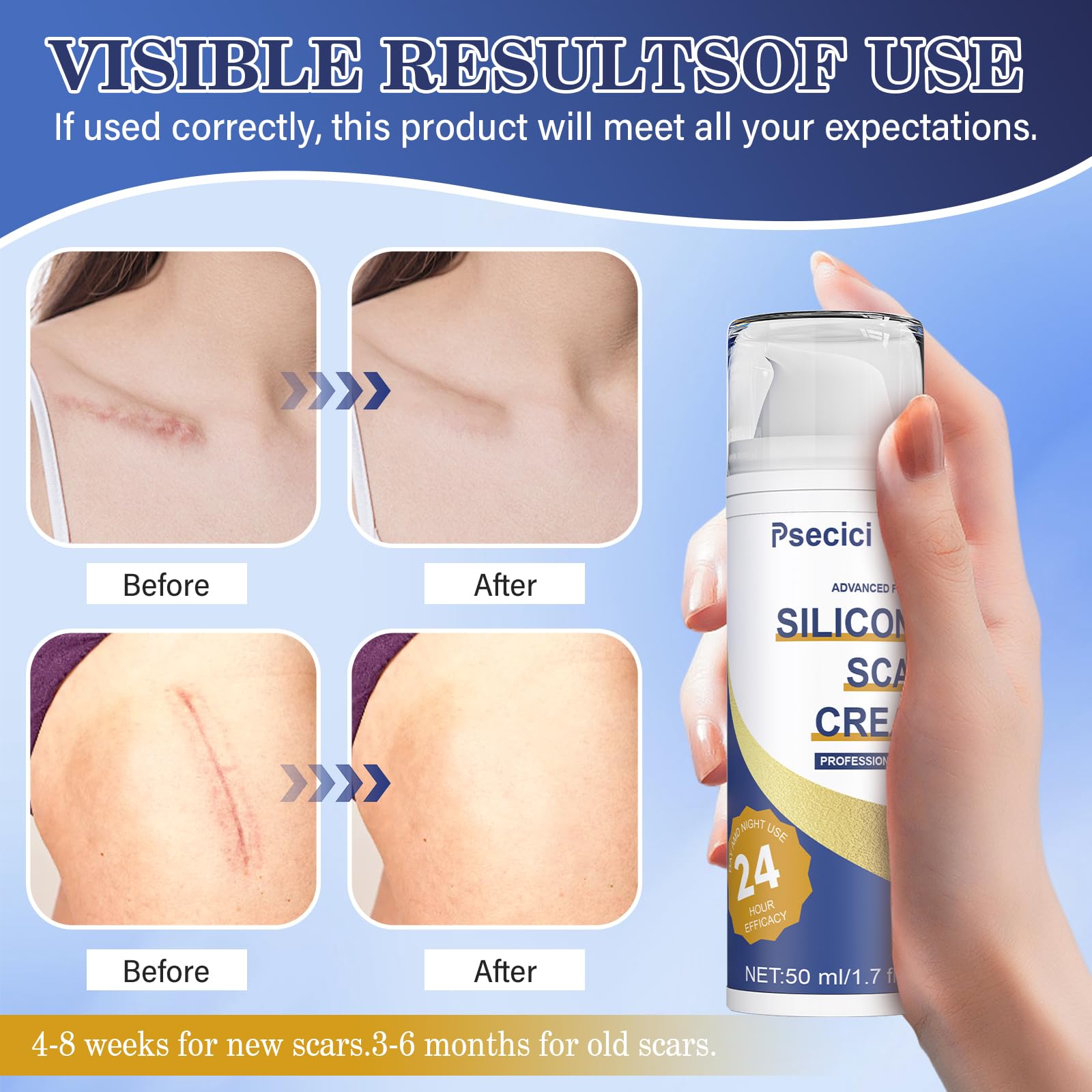 Psecici scar gel being massaged on skin, boosts evenness and moisture.