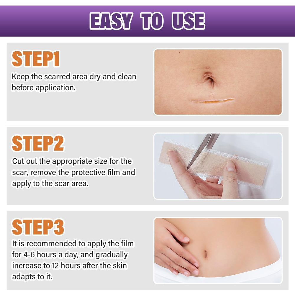Psecici silicone scar sheets address keloid concerns with discreet design