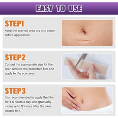 Psecici silicone scar sheets address keloid concerns with discreet design