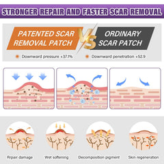 Psecici silicone scar sheets on skin show discreet wear under everyday clothing