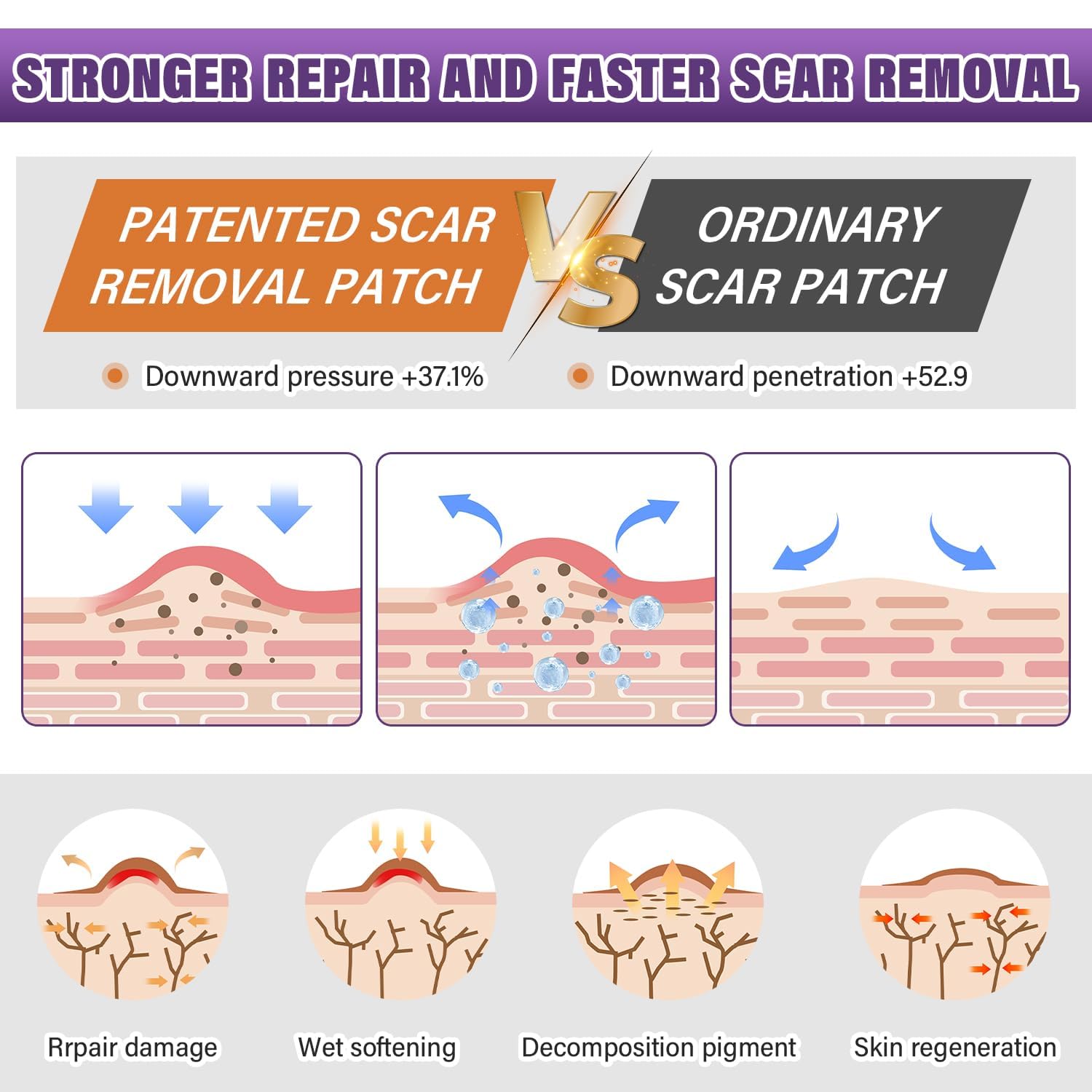 Psecici silicone scar sheets worn under clothing highlight comfortable 24-hour wear